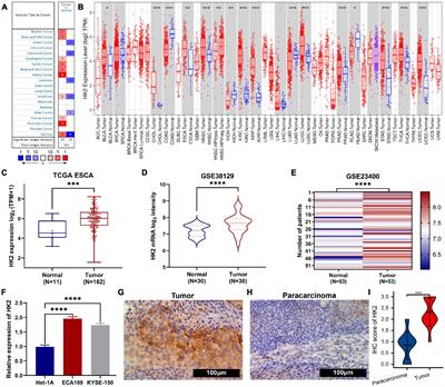Comprehensive Analysis of Hexokinase 2 Immune Infiltrates and m6A Related Genes in Human <mark class="highlighted">Esophageal Carcinoma</mark>